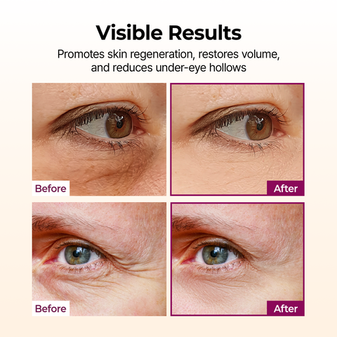 Dr.Melaxin Calcium Multi Balm resultados antes y despues contorno de ojos