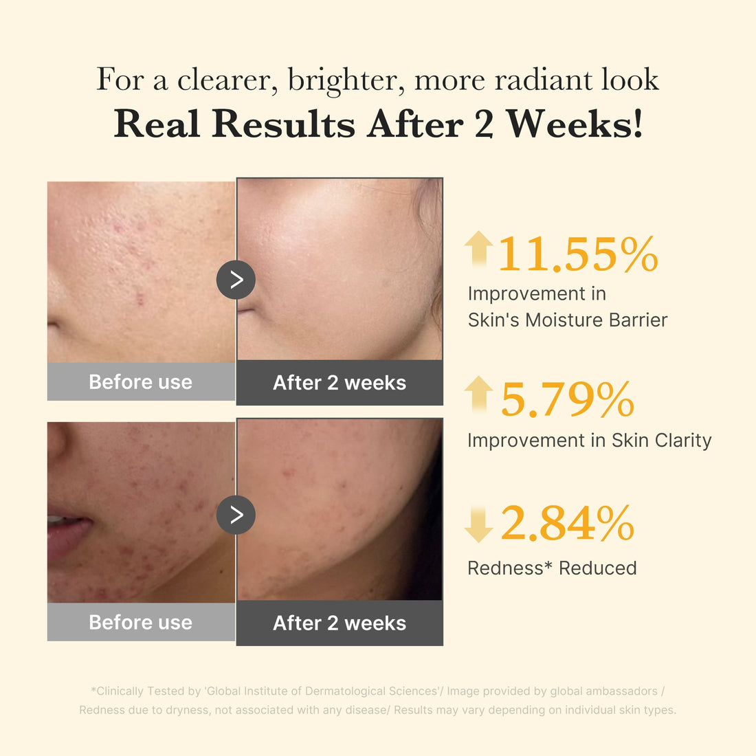 Medicube Kojic Acid Turmeric Niacinamide Serum — resultados en piel