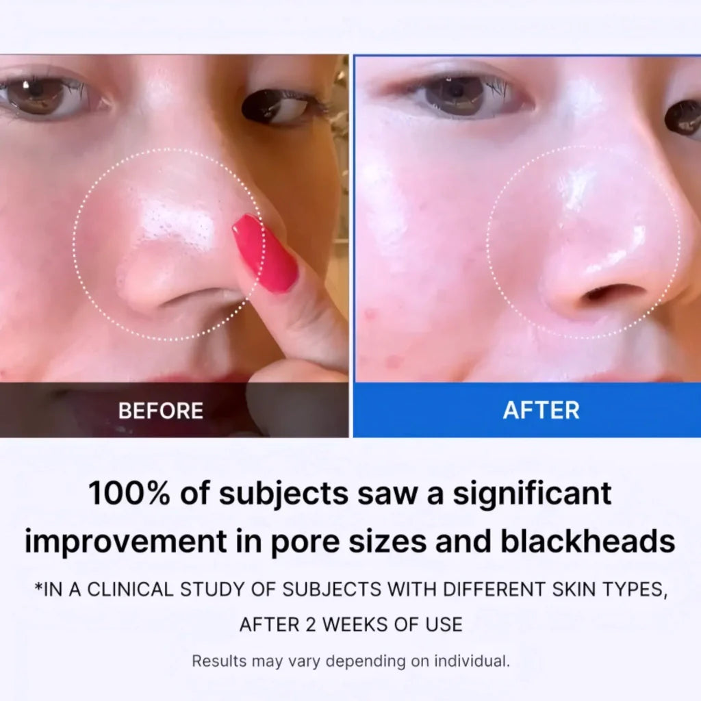 Medicube Zero Pore Pad 2.0 AHA BHA 70 Pads Exfoliantes - vista 6
