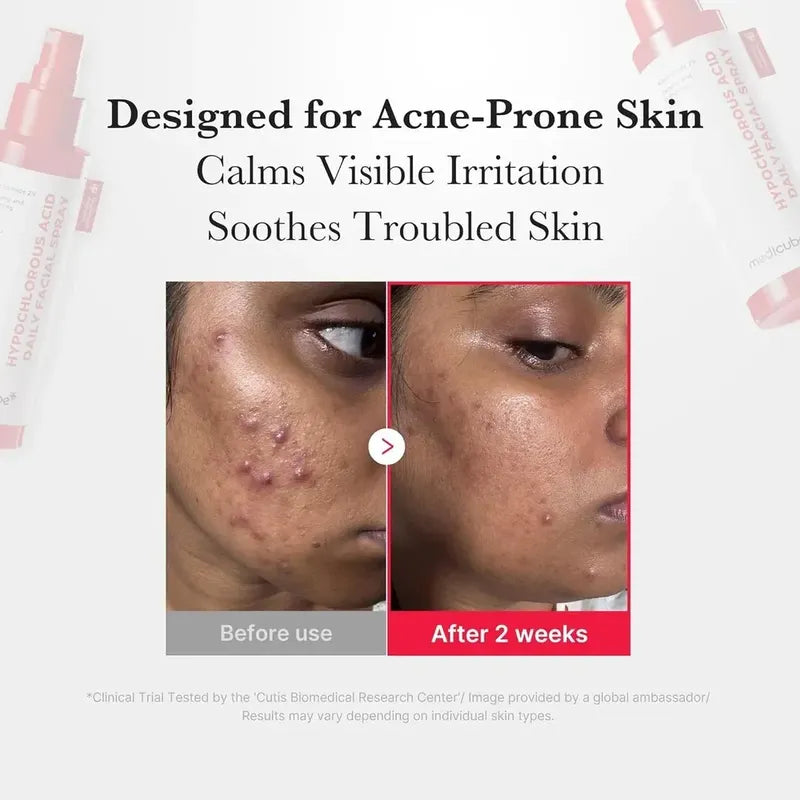 Spray Facial Medicube 125 Ml Ácido Hipocloroso — Textura | Glowup