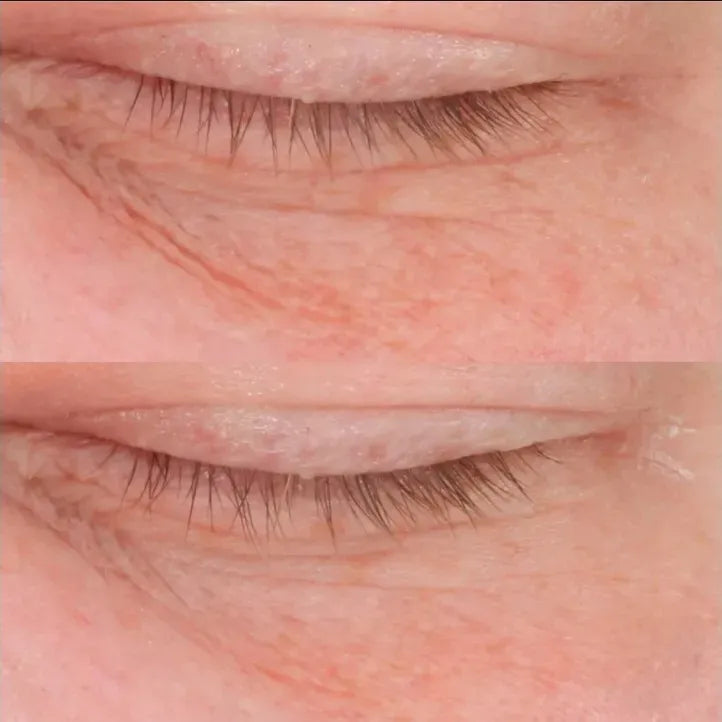 Contorno De Ojos Perricone Md Cold Plasma — Aplicación | Glowup