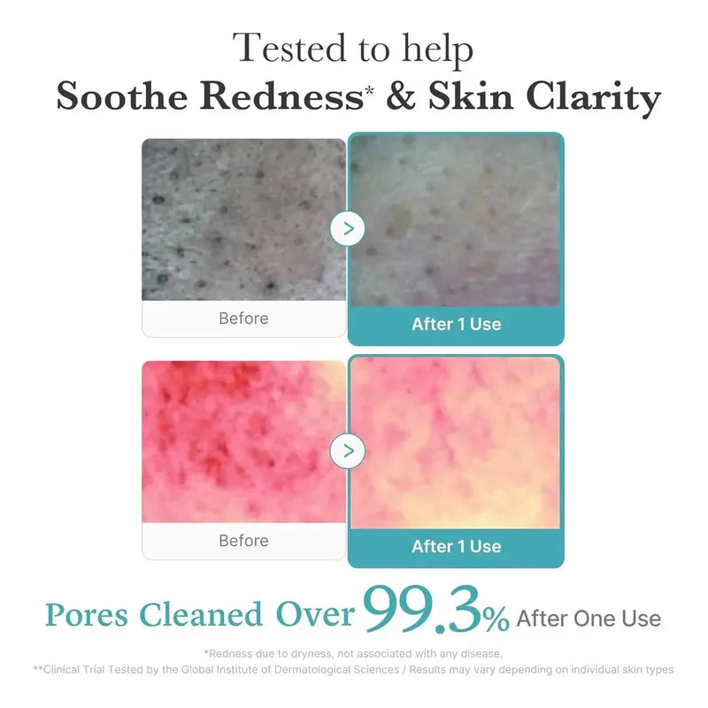 Medicube Azelaic Acid Niacinamide Deep Clean — Textura | Glowup