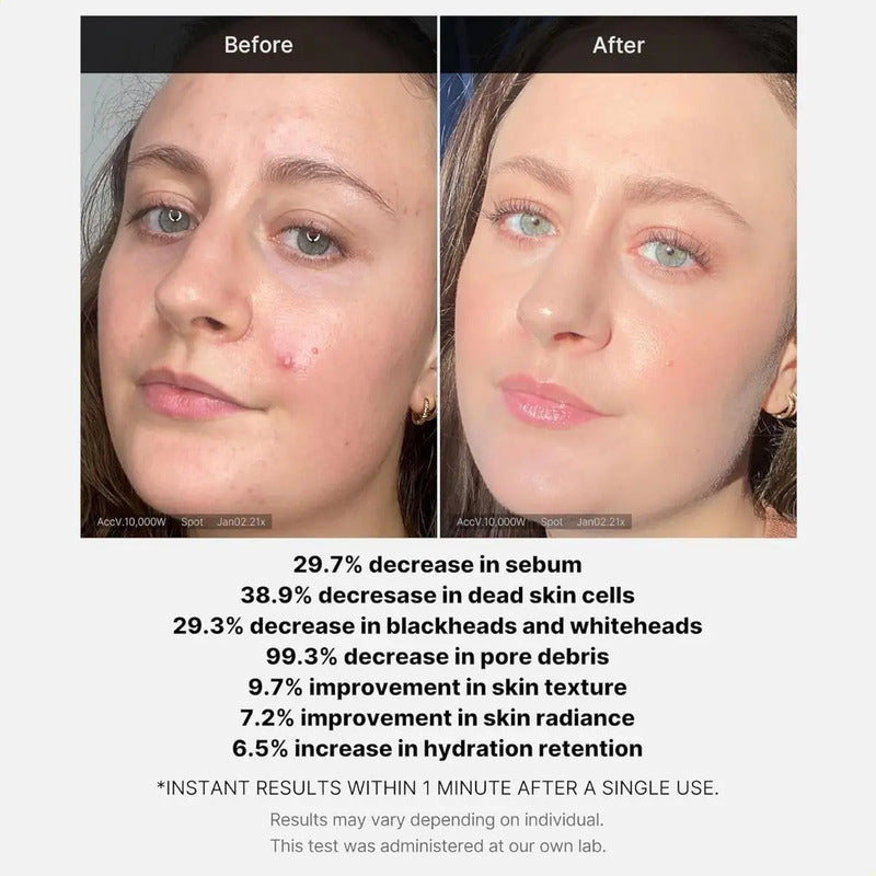 Exfoliante Limpiador Con Un 21% De Ácido — Textura | Glowup