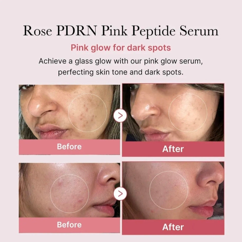 Sérum Hidratante Brillante Medicube Pdrn Pink — Ingredientes | Glowup